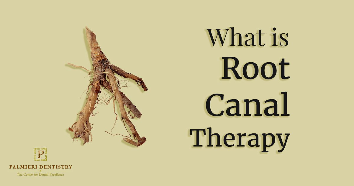Root Canal Therapy - Palmieri Dentistry